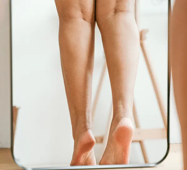 Lipedema